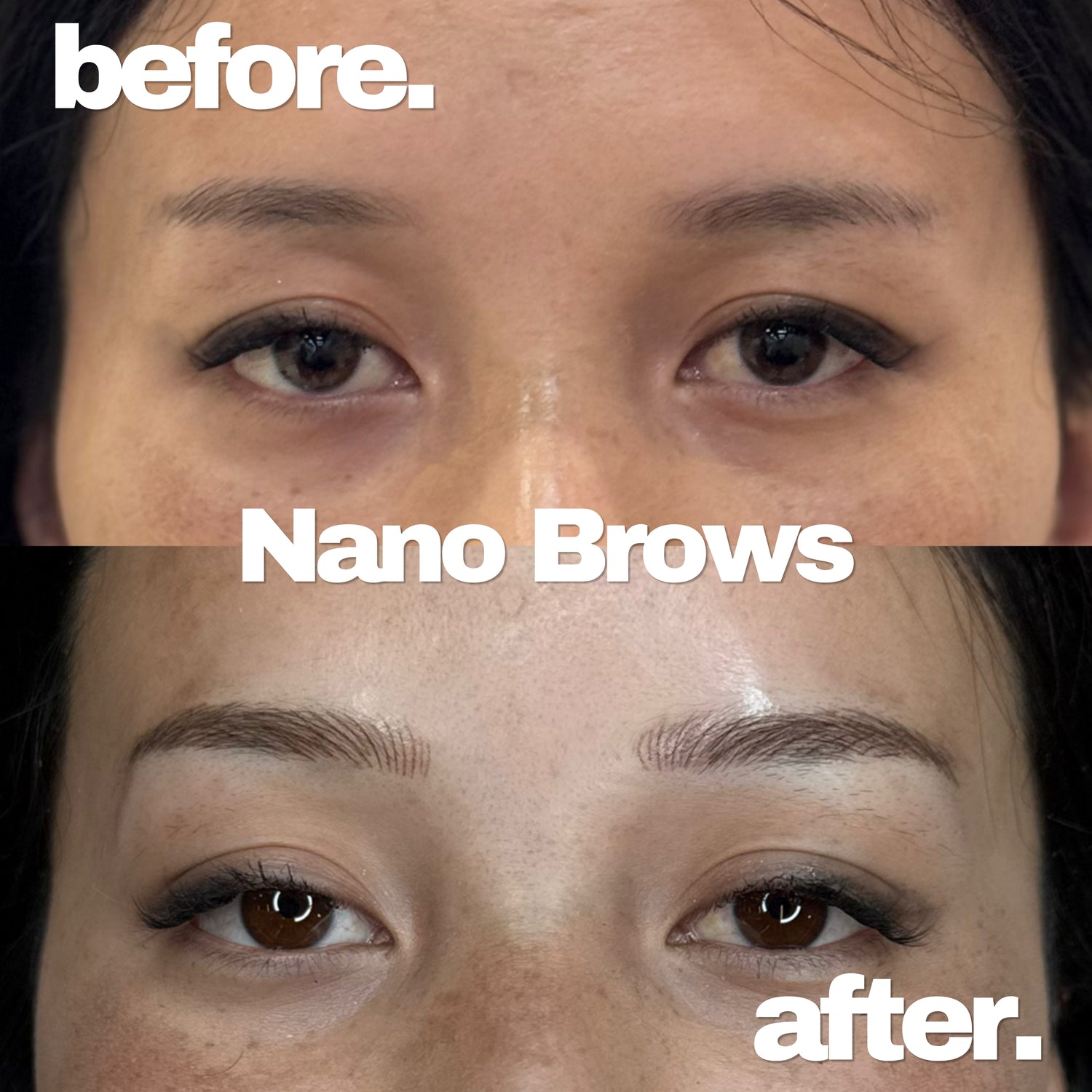 Before and after comparison of Nano Brows treatment on a person's eyebrows.